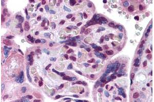 Human Placenta: Formalin-Fixed, Paraffin-Embedded (FFPE)