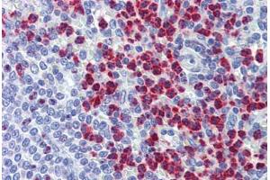 Spleen, Human: Formalin-Fixed, Paraffin-Embedded (FFPE)