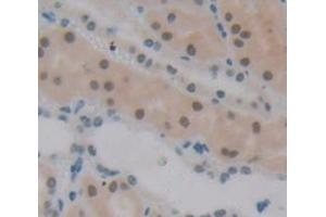 IHC-P analysis of Human Tissue, with DAB staining. (Polybromo 1 anticorps  (AA 957-1086))