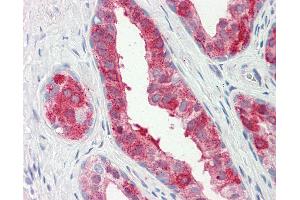 Human Prostate: Formalin-Fixed, Paraffin-Embedded (FFPE)