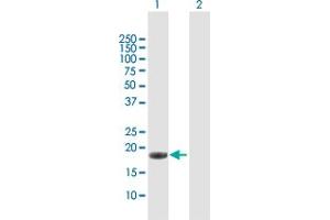 Western Blot analysis of IL17C expression in transfected 293T cell line by IL17C MaxPab polyclonal antibody. (IL17C anticorps  (AA 1-197))