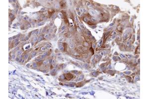 IHC-P Image Immunohistochemical analysis of paraffin-embedded SCC15 xenograft, using OSBPL6 , antibody at 1:100 dilution.