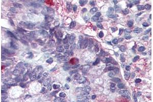 Image no. 1 for anti-Leucine-Rich Repeat Containing G Protein-Coupled Receptor 5 (LGR5) (Cytoplasmic Domain) antibody (ABIN1048834)