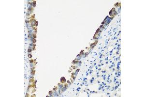 Immunohistochemistry of paraffin-embedded mouse lung using TNNC2 antibody at dilution of 1:200 (40x lens). (TNNC2 anticorps)
