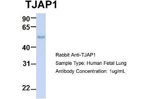 Host:  Rabbit  Target Name:  TJAP1  Sample Type:  Human Fetal Lung  Antibody Dilution:  1. (TJAP1 anticorps  (N-Term))