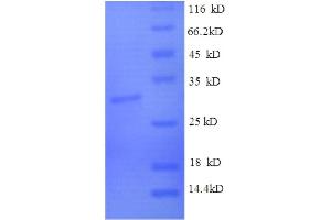 SDS-PAGE (SDS) image for Claudin 3 (CLDN3) (AA 30-80), (partial) protein (GST tag) (ABIN1608285)