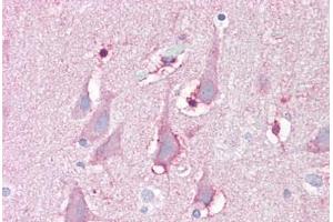 Anti-FBXL16 antibody IHC staining of human brain, cortex. (FBXL16 anticorps  (C-Term))