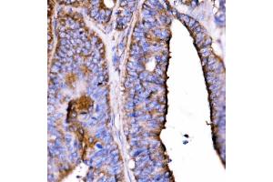 IHC analysis of 5HT1B/HTR1B using anti-5HT1B/HTR1B antibody (ABIN7601425).