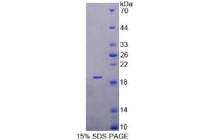 SDS-PAGE analysis of Mouse TBCA Protein. (TBCA Protéine)
