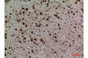 Immunohistochemistry (IHC) analysis of paraffin-embedded Human Brain, antibody was diluted at 1:100.