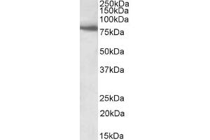 ABIN5539484 (1µg/ml) staining of Human Skeletal Muscle lysate (35µg protein in RIPA buffer). (BBS7 anticorps  (Internal Region))