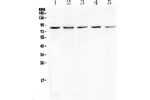 Western blot analysis of RNF43 using anti-RNF43 antibody . (RNF43 anticorps  (AA 24-197))
