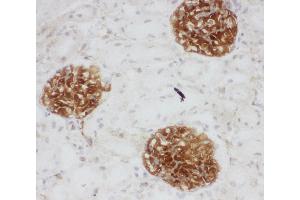 Anti-CD34 antibody, IHC(F) IHC(F): Rat Kidney Tissue