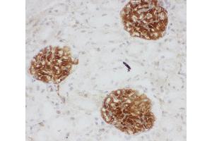 Anti-CD34 antibody, IHC(F) IHC(F): Rat Kidney Tissue (CD34 anticorps  (C-Term))