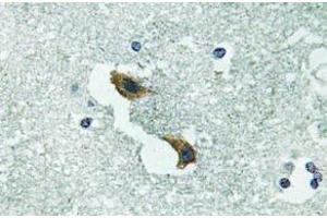 Immunohistochemistry (IHC) analyzes of ATP7A antibody in paraffin-embedded human brain tissue. (ATP7A anticorps)