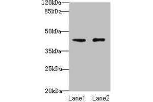 Western blot All lanes: VPS45 antibody at 3 μg/mL Lane 1: Mouse brain tissue Lane 2: U87 whole cell lysate Secondary Goat polyclonal to rabbit IgG at 1/10000 dilution Predicted band size: 66, 62 kDa Observed band size: 41 kDa (VPS45 anticorps  (AA 101-400))