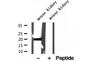 Western blot analysis of extracts of mouse kidney tissue, using MPV17 antibody. (MPV17 anticorps  (Internal Region))