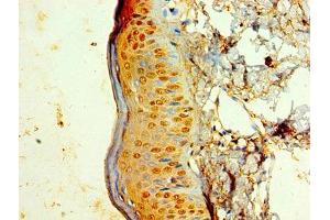 Immunohistochemistry of paraffin-embedded human skin tissue using ABIN7157433 at dilution of 1:100