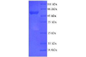 SDS-PAGE (SDS) image for Adaptor-Related Protein Complex 2, mu 1 Subunit (AP2M1) (AA 1-435), (full length) protein (His tag) (ABIN5713232)
