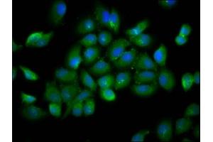 Immunofluorescence staining of A549 cells with ABIN7174389 at 1:166, counter-stained with DAPI. (YOD1 anticorps  (AA 1-44))