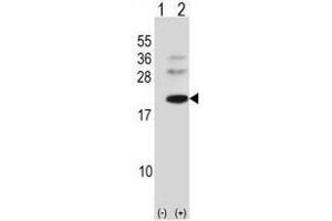 Western blot analysis of BARX1 (arrow) using rabbit polyclonal BARX1 Antibody (C-term) . (BARX1 anticorps  (C-Term))