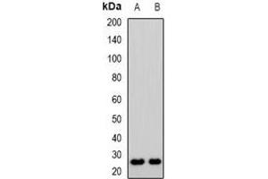 Western blot analysis of CD53 expression in KB (A), Jurkat (B) whole cell lysates. (CD53 anticorps)