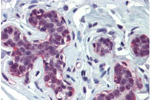 anti-CREB Binding Protein (CREBBP) (AA 144-193) antibody