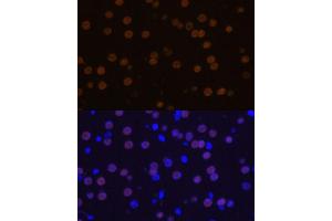 Immunofluorescence analysis of mouse brain using MEF2C Polyclonal Antibody (ABIN6132345, ABIN6143716, ABIN6143717 and ABIN6215998) at dilution of 1:100 (40x lens).
