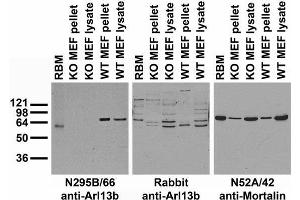 Immunostaining of KIF24-depleted Panc1 cells in serum-starved medium treated with DMSO or 1 μM SAG for 48 h.