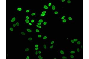Immunofluorescence staining of Hela cells with ABIN7139600 at 1:5, counter-stained with DAPI.