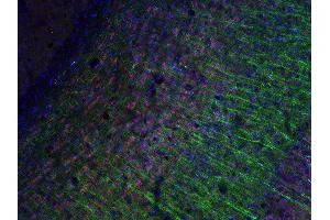 Indirect immunostaining of PFA fixed mouse brain sections with anti-Tbr 1 (dilution 1 : 200; red) and mouse anti-MAP 2 (, dilution 1 : 200; green). (TBR1 anticorps  (AA 128-145))