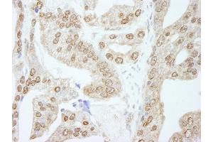 Immunohistochemistry (IHC) image for anti-Cyclin E1 (CCNE1) (AA 360-410) antibody (ABIN7448507)
