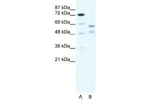 TRIM23 antibody (20R-1190) used at 0. (TRIM23 anticorps  (C-Term))