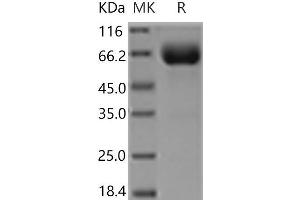 Western Blotting (WB) image for Growth Hormone Receptor (GHR) (Active) protein (Fc Tag) (ABIN7321235)