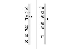 Western blot analysis of anti-hSUV39H2- Pab (Cat.