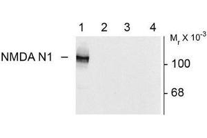 Image no. 1 for anti-NMDA Receptor 1 (NMDA R1) (Splice Variant N1) antibody (ABIN372678) (NMDA 1 Receptor anticorps  (Splice Variant N1))