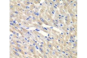 Immunohistochemistry of paraffin-embedded Mouse heart using CARS Polyclonal Antibody at dilution of 1:100 (40x lens). (CARS anticorps)