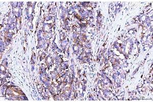 IHC analysis of Poliovirus Receptor/PVR using anti-Poliovirus Receptor/PVR antibody (ABIN7601072). (Poliovirus Receptor anticorps  (AA 28-331))