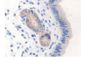 IHC-P analysis of Mouse Uterus Tissue, with DAB staining. (NOS1 anticorps  (AA 53-247))