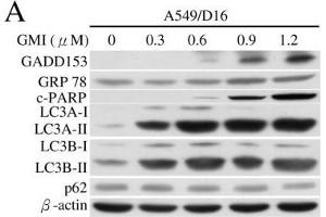 Analyses of GMI, TG and TM regulated ER stress, apoptosis and autophagy by Western blotting.