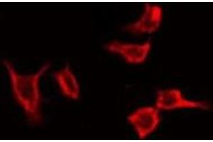 ABIN6274227 staining Hela by IF/ICC. (Coronin 1a anticorps  (Internal Region))