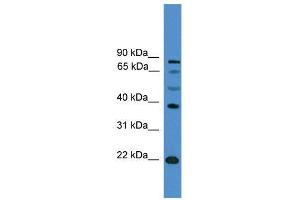 WB Suggested Anti-ASCL2  Antibody Titration: 0. (ASCL2 anticorps  (C-Term))
