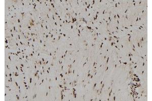 ABIN6273014 at 1/100 staining Rat heart tissue by IHC-P. (RNH1 anticorps  (Internal Region))