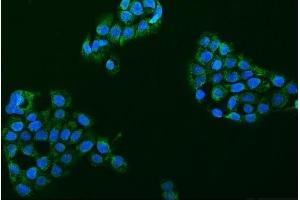IF analysis of ASIC2 using anti-ASIC2 antibody (ABIN7601023).