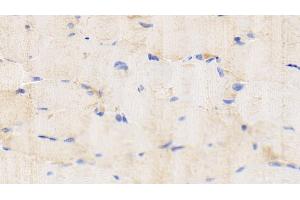 Detection of IL1b in Caprine Skeletal muscle Tissue using Polyclonal Antibody to Interleukin 1 Beta (IL1b)