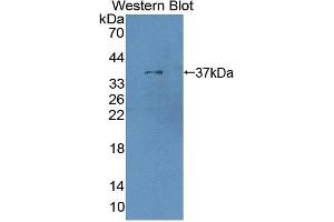 Detection of Recombinant XRN1, Human using Polyclonal Antibody to 5'-3'Exoribonuclease 1 (XRN1) (XRN1 anticorps  (AA 1394-1706))