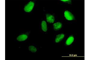 Immunofluorescence of purified MaxPab antibody to KIF22 on HeLa cell.
