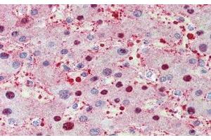 Detection of TBG in Human Liver Tissue using Polyclonal Antibody to Thyroxine Binding Globulin (TBG)