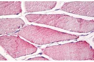 Human Skeletal Muscle: Formalin-Fixed, Paraffin-Embedded (FFPE) (CPNE6 anticorps)