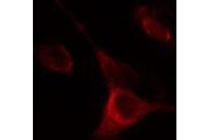 ABIN6275285 staining Hela cells by IF/ICC. (NOX5 anticorps  (C-Term))